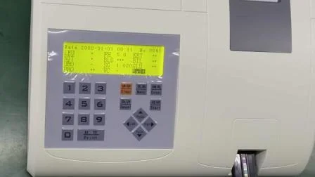 CE によって承認された病院機器ポータブル尿分析装置