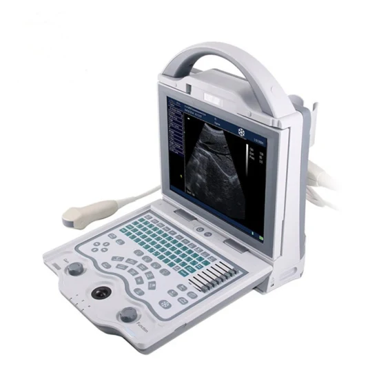 ポータブル ドップラー超音波診断システムの価格カラー ドップラー超音波診断システム